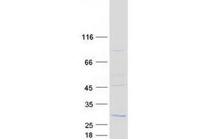 Validation with Western Blot (RD3 Protein (Myc-DYKDDDDK Tag))