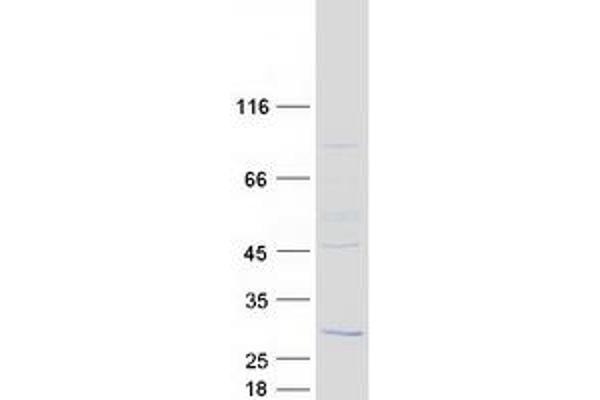 RD3 Protein (Myc-DYKDDDDK Tag)