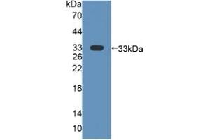 Detection of Recombinant FMO2, Human using Polyclonal Antibody to Flavin Containing Monooxygenase 2, Non Functional (FMO2) (FMO2 antibody  (AA 295-469))