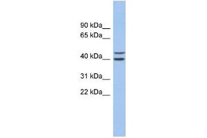 WB Suggested Anti-FBXL14 Antibody Titration: 0. (FBXL14 antibody  (N-Term))