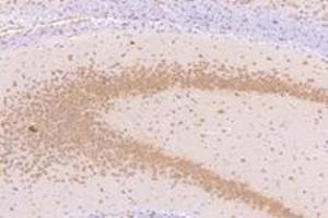 Immunohistochemistry analysis of paraffin-embedded mouse substantia nigra using NMU (ABIN7074818) at dilution of 1: 1000