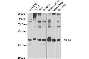 Western blot analysis of extracts of various cell lines, using  Antibody (ABIN6129197, ABIN6137129, ABIN6137130 and ABIN6223718) at 1:1000 dilution. (ARPC3 antibody  (AA 1-178))