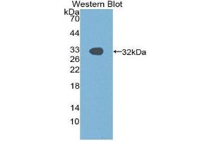 Western Blotting (WB) image for anti-P21-Activated Kinase 1 (PAK1) (AA 252-501) antibody (ABIN1869663) (PAK1 antibody  (AA 252-501))