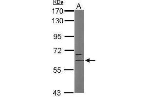 WB Image Sample (50 ug of whole cell lysate) A: Mouse brain 7. (MYST2 antibody  (Internal Region))