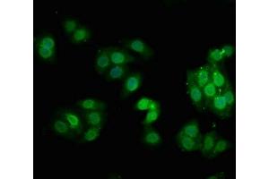 Immunofluorescence staining of HepG2 cells with ABIN7127730 at 1:100,counter-stained with DAPI. (Recombinant PKC alpha antibody  (pThr638))