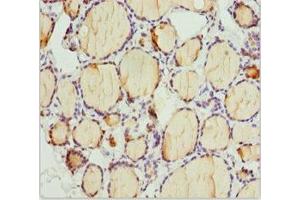 Immunohistochemistry of paraffin-embedded human thyroid tissue using ABIN7163636 at dilution of 1:100 (PLEKHA1 antibody  (AA 285-404))