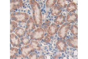 Used in DAB staining on fromalin fixed paraffin- embedded kidney tissue (PLCL1 antibody  (AA 891-1096))