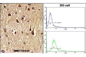 (LEFT)Formalin-fixed and paraffin-embedded human brain tissue reacted with FKHR Antibody (Center ), which was peroxidase-conjugated to the secondary antibody, followed by DAB staining. (FOXO1 antibody  (AA 454-482))