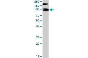 CDCP1 polyclonal antibody  staining (1 ug/mL) of human colon lysate (35 ug protein in RIPA buffer). (CDCP1 antibody  (C-Term))