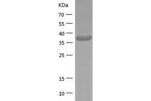 Western Blotting (WB) image for Adenosine Deaminase (ADA) (AA 1-363) protein (His tag) (ABIN7121707) (ADA Protein (AA 1-363) (His tag))