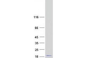 Validation with Western Blot (TEKT4P2 Protein (Myc-DYKDDDDK Tag))