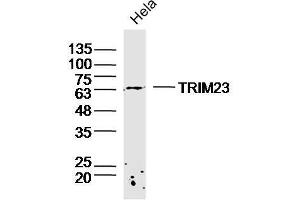 Hela lysates probed with TRIM23 Polyclonal Antibody, Unconjugated  at 1:300 dilution and 4˚C overnight incubation. (TRIM23 antibody  (AA 201-300))