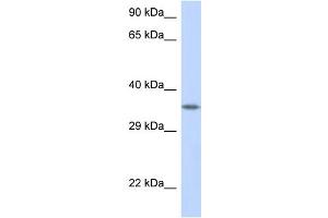 WB Suggested Anti-CRK Antibody Titration: 1. (Crk antibody  (C-Term))