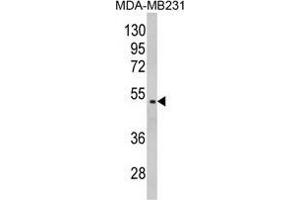 Western blot analysis of GALT Antibody (C-term) in MDA-MB231 cell line lysates (35 µg/lane). (GALT antibody  (C-Term))