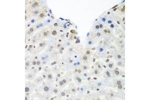 Immunohistochemistry of paraffin-embedded mouse liver using TARDBP antibody. (TARDBP antibody  (AA 1-100))