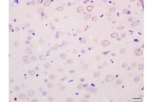 Formalin-fixed and paraffin embedded rat brain labeled with Anti-MOT8/SLC16A2 Polyclonal Antibody, Unconjugated (ABIN1387834) at 1:200 followed by conjugation to the secondary antibody and DAB staining (SLC16A2/MCT8 antibody  (AA 101-200))