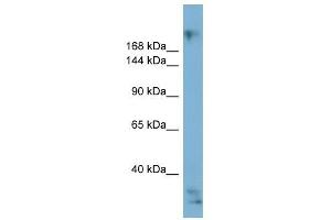 EXPH5 antibody used at 1 ug/ml to detect target protein. (Exophilin 5 antibody  (Middle Region))