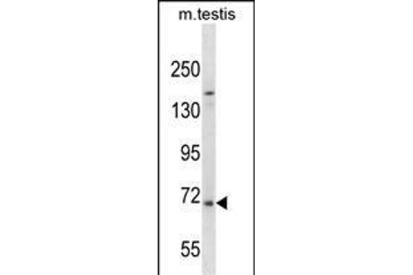 EXTL1 antibody  (C-Term)