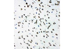 Immunohistochemistry (IHC) image for anti-SHC (Src Homology 2 Domain Containing) Transforming Protein 1 (SHC1) (AA 424-440), (C-Term) antibody (ABIN3044111)