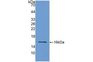 Detection of Recombinant LOXL2, Mouse using Polyclonal Antibody to Lysyl Oxidase Like Protein 2 (LOXL2) (LOXL2 antibody  (AA 53-160))