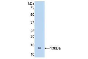 Detection of Recombinant S100A8, Human using Polyclonal Antibody to S100 Calcium Binding Protein A8 (S100A8) (S100A8 antibody  (AA 1-93))