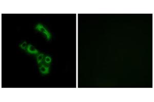 Immunofluorescence analysis of A549 cells, using C1QB antibody. (C1QB antibody  (C-Term))