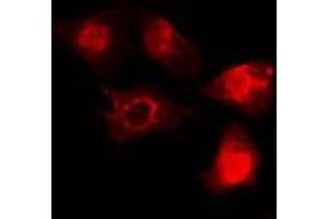 ABIN6268665 staining HeLa cells by IF/ICC. (SMAD5 antibody  (Internal Region))