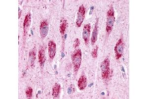 Anti-GPR3 antibody  ABIN1048790 IHC staining of human brain, neurons and glia. (GPR3 antibody  (Extracellular Domain))