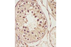 (ABIN6243400 and ABIN6578788) staining NSFL1C in human testis tissue sections by Immunohistochemistry (IHC-P - paraformaldehyde-fixed, paraffin-embedded sections). (NSFL1C antibody  (AA 214-248))