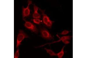 ABIN6276293 staining 293 by IF/ICC. (BCL2L1 antibody  (N-Term))