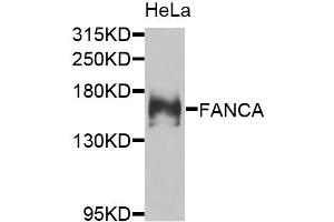 Western blot analysis of extracts of HeLa cells, using FANCA antibody.