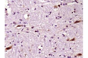 Paraformaldehyde-fixed, paraffin embedded mouse brain, Antigen retrieval by boiling in sodium citrate buffer (pH6) for 15min, Block endogenous peroxidase by 3% hydrogen peroxide for 30 minutes,  Blocking buffer (normal goat serum) at 37°C for 20min, Antibody incubation with LIMK1 Polyclonal Antibody (bs-2775R) at 1:400 overnight at 4°C, followed by a conjugated secondary and DAB staining. (LIM Domain Kinase 1 antibody  (AA 451-550))