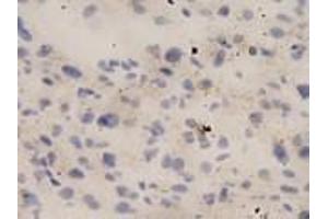 IHC-P analysis of human liver tissue, using IL18 antibody (1/10 dilution). (IL-18 antibody  (full length))