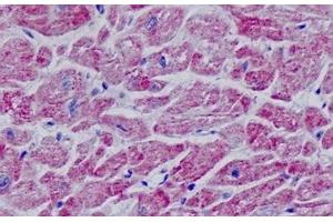 Human, Heart: Formalin-Fixed Paraffin-Embedded (FFPE) (MYF5 antibody  (AA 61-110))