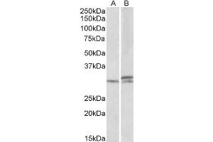 ABIN570860 (1µg/ml) staining of Mouse and Rat Spinal Cord lysates (35µg protein in RIPA buffer). (HOXA9 antibody  (AA 37-50))