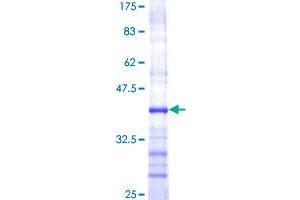 GZMB Protein (AA 148-247) (GST tag)