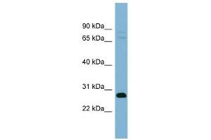 TMEM176A antibody used at 1 ug/ml to detect target protein. (TMEM176A antibody  (Middle Region))