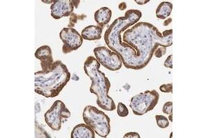 Immunohistochemical staining of human placenta with JOSD1 polyclonal antibody  shows strong cytoplasmic positivity in trophoblastic cells at 1:50-1:200 dilution. (JOSD1 antibody)