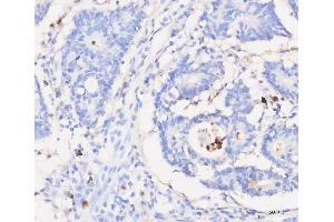 IHC analysis of Grancalcin/GCA using anti-Grancalcin/GCA antibody (ABIN6719568).