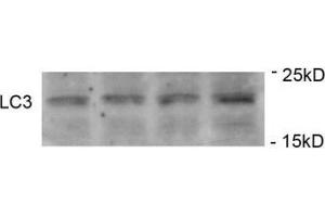 Western Blotting (WB) image for anti-Microtubule-Associated Protein 1 Light Chain 3 gamma (MAP1LC3C) (pSer12) antibody (ABIN3031792)