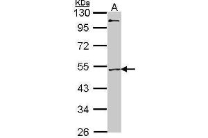 Western Blotting (WB) image for anti-Myocyte Enhancer Factor 2A (MEF2A) (C-Term) antibody (ABIN2855000)