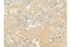 ABIN6262978 and ABIN6276676 at 1/100 staining human normal lung tissue by IHC-P.