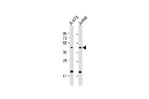 All lanes : Anti-IL11RA Antibody (C-Term) at 1:2000 dilution Lane 1: A-673 whole cell lysate Lane 2: Jurkat whole cell lysate Lysates/proteins at 20 μg per lane. (IL11RA antibody  (AA 372-403))