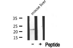 Western blot analysis of extracts from mouse liver, using MRPL20 antibody. (MRPL20 antibody  (C-Term))