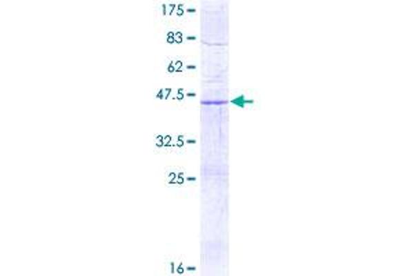 SDHD Protein (AA 1-159) (GST tag)