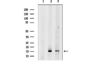 anti-Phospholipase A2, Group IIA (Platelets, Synovial Fluid) (PLA2G2A) (Internal Region) antibody