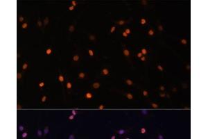 Immunofluorescence analysis of C6 cells using PRKCB Polyclonal Antibody at dilution of 1:100 (40x lens).
