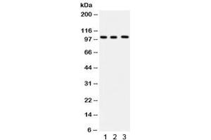 Western blot testing of 1) human HeLa, 2) Raji and 3) U937 lysate with ITCH antibody. (ITCH antibody)