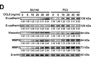 Western Blotting (WB) image for anti-Matrix Metalloproteinase 2 (MMP2) (AA 40-280) antibody (ABIN6143911)
