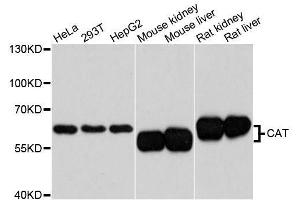 Western blot analysis of extracts of various cell lines, using CAT antibody. (Catalase antibody  (AA 1-225))